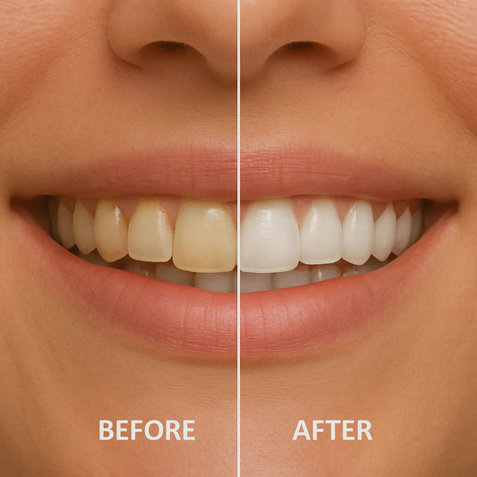 🦷 Nano zobna pasta (n-Ha) – Popravi sklenino + Zmanjša občutljivost! ✨