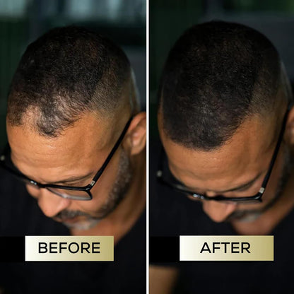 （🔥Kupite 1, dobite 1 gratis🔥）Korektor lasišča za gostejše in bolj naravne lase