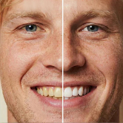 😁Zobna pasta za takojšnje beljenje zob🦷【🔥Kupite 1, dobite 1 gratis🔥】