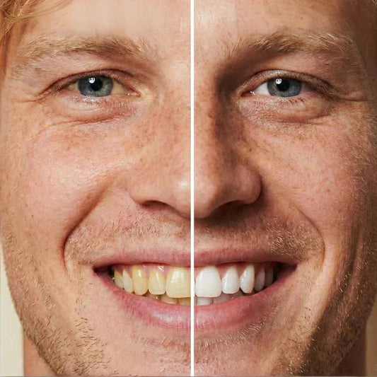 😁Zobna pasta za takojšnje beljenje zob🦷【🔥Kupite 1, dobite 1 gratis🔥】