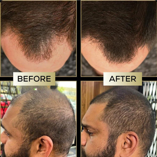 （🔥Kupite 1, dobite 1 gratis🔥）Korektor lasišča za gostejše in bolj naravne lase