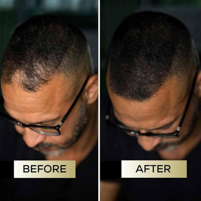 （🔥Kupite 1, dobite 1 gratis🔥）Korektor lasišča za gostejše in bolj naravne lase