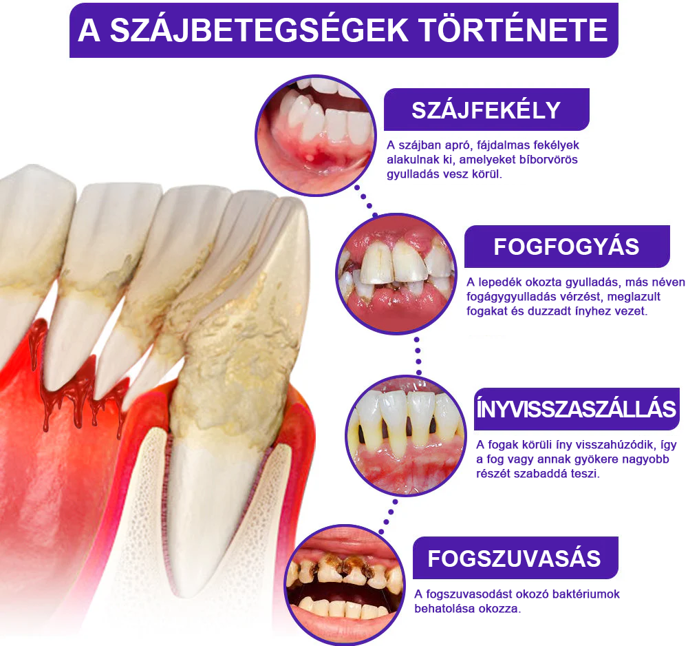 🌟Rolimey® VioCore zobna pasta s čebeljim strupom
