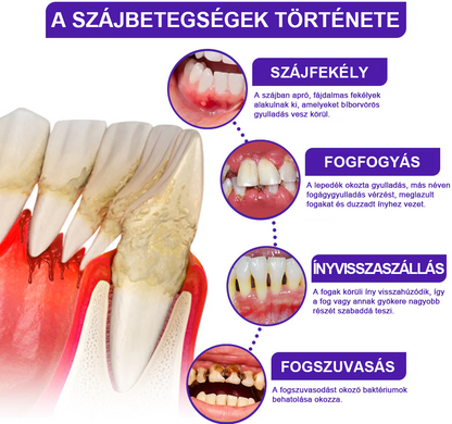 🌟Rolimey® VioCore zobna pasta s čebeljim strupom