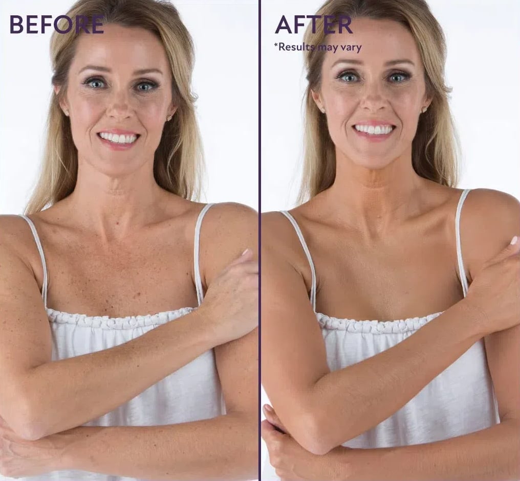 Izboljševalec cele polti