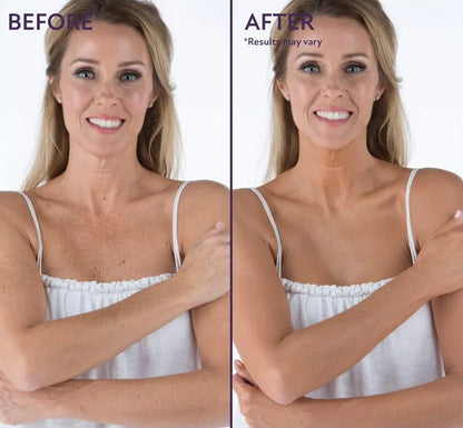 Izboljševalec cele polti