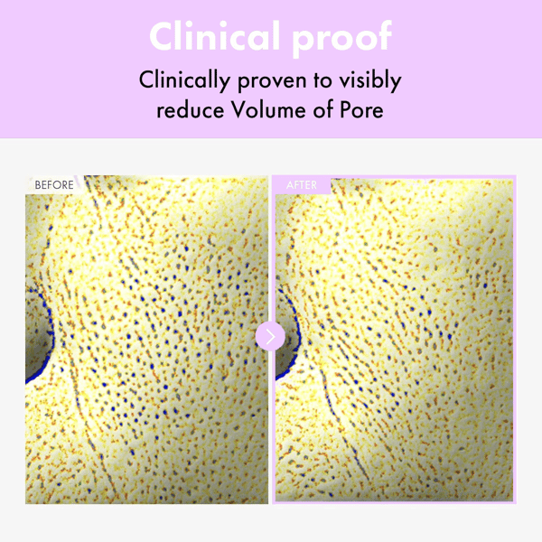 （🔥Kupite 1 dobite 1 gratis🔥) Bakuchiol serum za polnjenje por in zmanjševanje gub