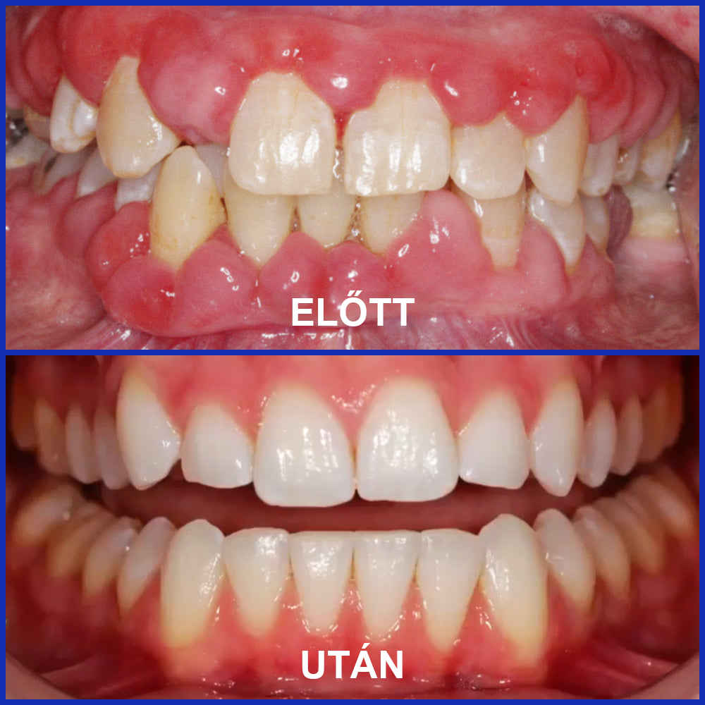 🌟Rolimey® VioCore zobna pasta s čebeljim strupom