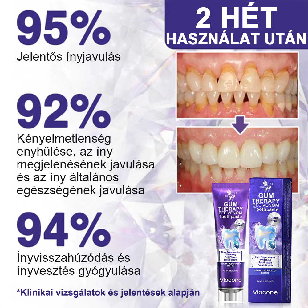 🌟Rolimey® VioCore zobna pasta s čebeljim strupom