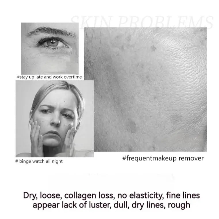 【🎁Več ko kupite, več popustov dobite】2025 NOVA polipeptidna učvrstitvena krema za celoten obraz