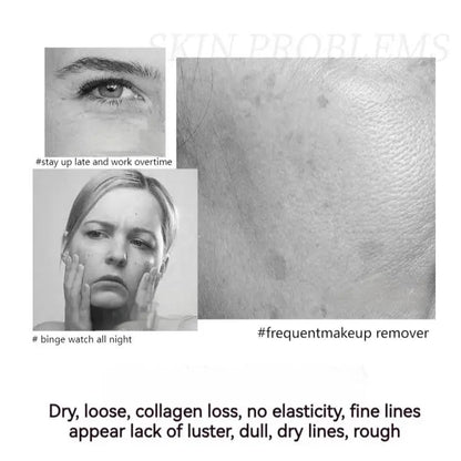 【🎁Več ko kupite, več popustov dobite】2025 NOVA polipeptidna učvrstitvena krema za celoten obraz