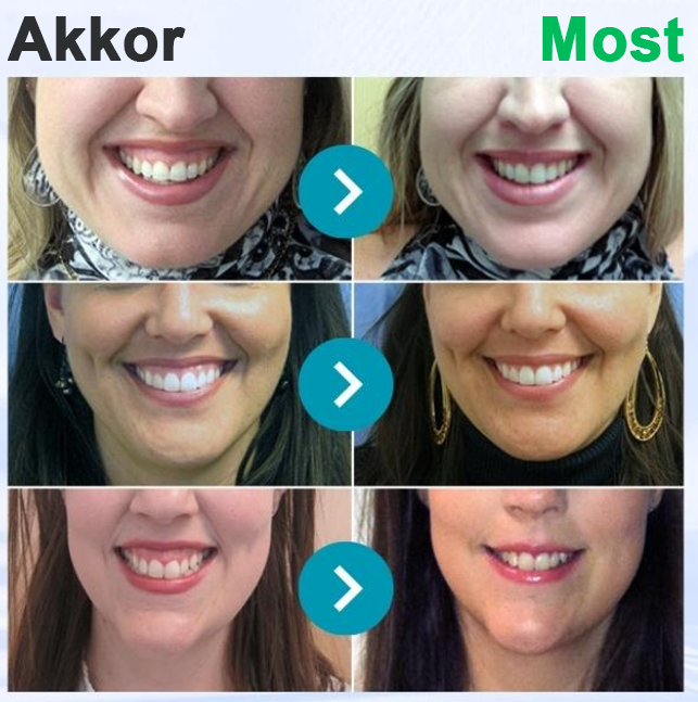 🌟Rolimey® VioCore zobna pasta s čebeljim strupom