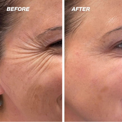 （🔥Kupite 1 dobite 1 gratis🔥)Vroča razprodaja 41 % POPUSTA - HOOMWELL™ Vita A Retinal Shot za učvrstitev mrežnice