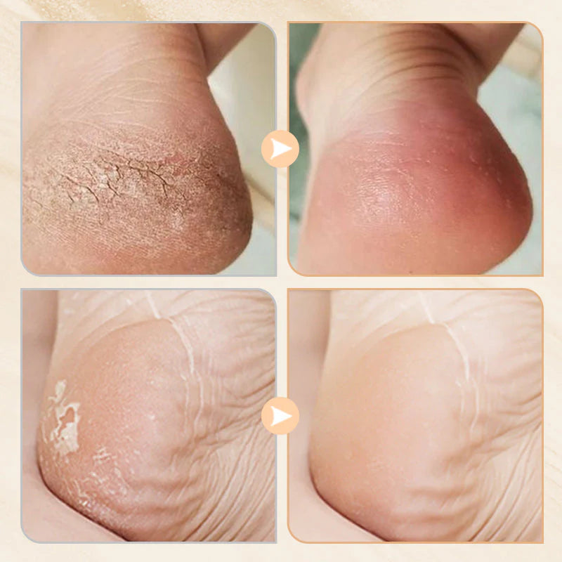 🌟 Regeneracijski balzam za suho kožo – naraven, intenziven in vse namenjeno! 🧴