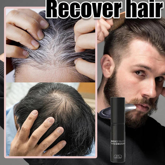 （🔥Kupite 1, dobite 1 gratis🔥）Korektor lasišča za gostejše in bolj naravne lase