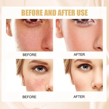 （🔥Kupite 1, dobite 1 gratis🔥）Podlaga za zrelo kožo z razbarvanjem