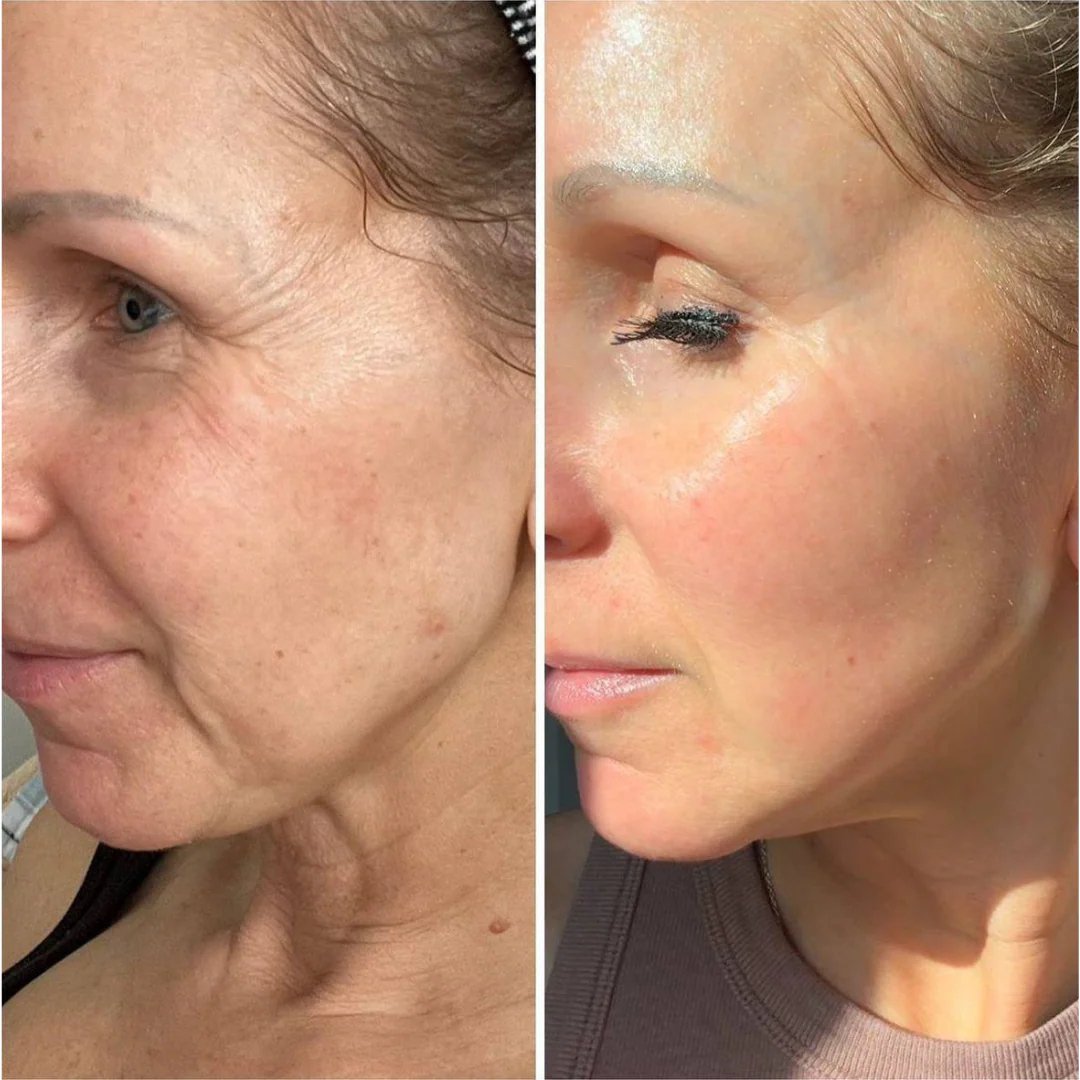 （🔥Kupite 1 dobite 1 gratis🔥)Vroča razprodaja 41 % POPUSTA - HOOMWELL™ Vita A Retinal Shot za učvrstitev mrežnice