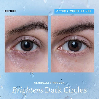 🎁Več ko kupite, več popustov dobite，Aqua Bomb Eye Gel - vlažilna, proti zabuhlosti in polnejša krema za oči